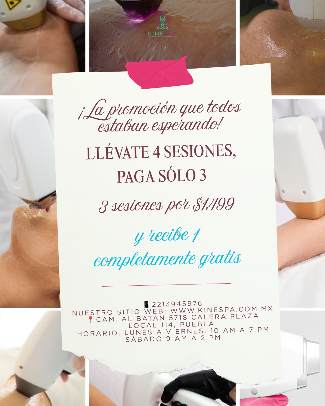 Paquete depilación láser 4 sesiones por $1,499, una sesión gratis — Kinespa Julio 2026